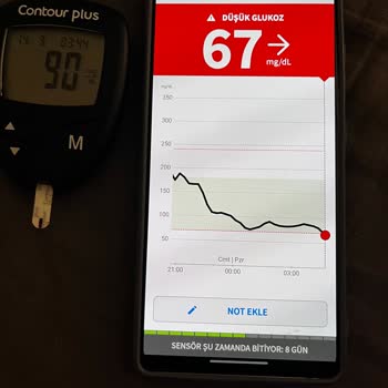 Freestyle Libre Libre2 Plus Yanlış Ölçüm Hatası Veriyor