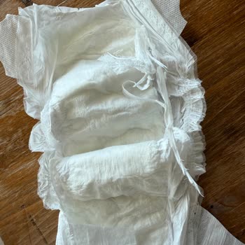 Sleepy Natural Bebek Bezinde Sert Cisim Ve Müşteri Hizmetleri Sorunu