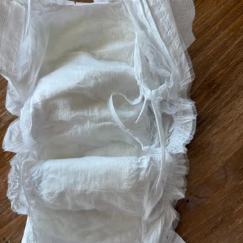 Sleepy Natural Bebek Bezinde Sert Cisim Ve Müşteri Hizmetleri Sorunu