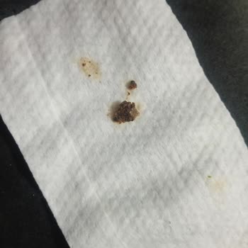 Cips Paketinde Yabancı Maddeyle Karşılaştım