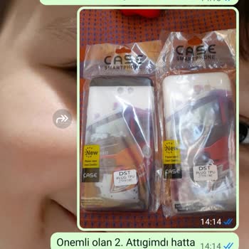 Yanlış Baskılı Kılıf Gönderildi, Sorunum Çözülmüyor