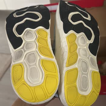 Ayakkabıdaki Açılma İçin Çözüm Sunulmadı, Mağduriyetim Giderilmedi