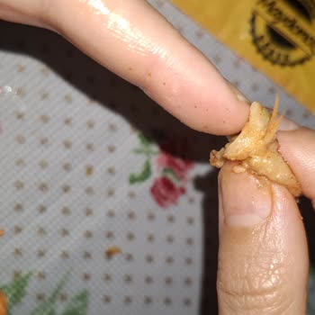 Maydonoz Döner Hijyen Sorunu Ve Fatura Eksikliği Nedeniyle Ücret İadesi Talebi