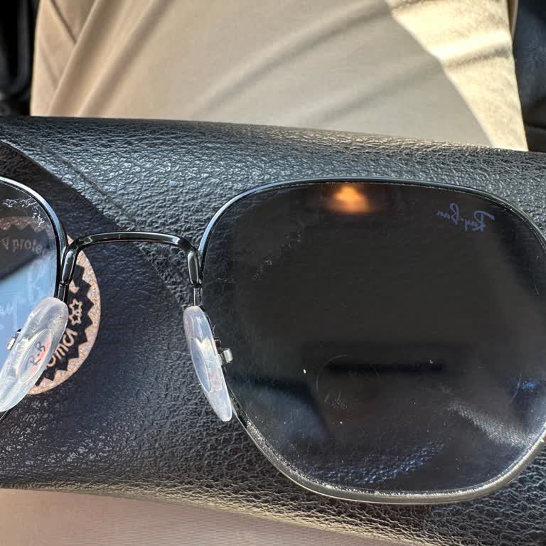 Rayban Gözlükte Kaplama Sorunu Ve Atasun Optik'in İlgisizliği