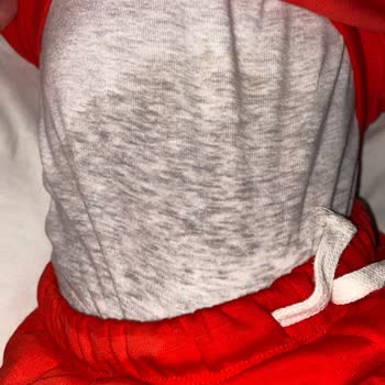 Molfix 5 Numara Bezde Sürekli Sızdırma Sorunu Ve Ücret İade Talebi