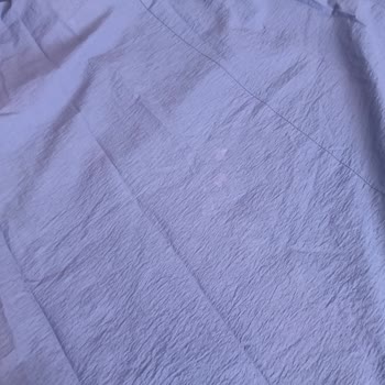 Satın Aldığım Elbisede Renk Solması Ve Mağduriyet