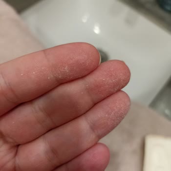 Sleepy Pedler Pul Pul Dökülüyor Çamaşırım Daha Çok Kirleniyor