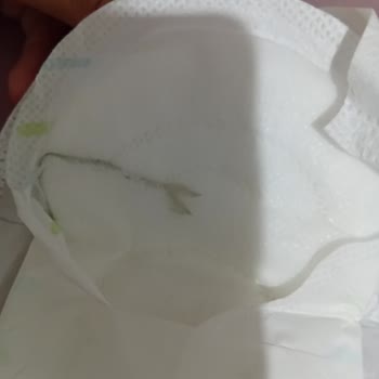 Sleepy Bio Natural Hijyen Pedinde Sert Cisim Çıkması