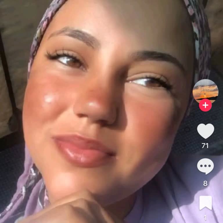 İzinsiz Paylaşılan Fotoğrafım Ve Uygunsuz Yorumlar Nedeniyle Endişeliyim