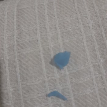 Noodle İçinden Çıkan Plastik Parça Sağlığımı Riske Attı