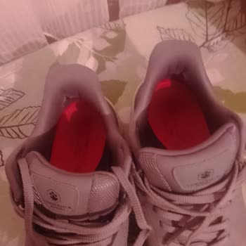 Aldığım Ayakkabı 1 Ayda Yırtıldı, Mağaza İlgilenmiyor