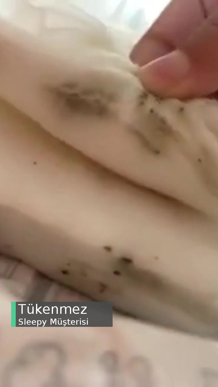 Sleepy Küflü Bebek Mendili videonun kapak resmi