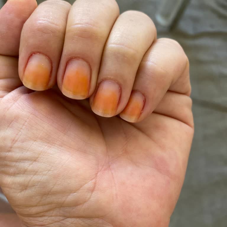 Flormar Oje Sonrası Tırnaklarda Kalıcı Turuncu Leke Sorunu
