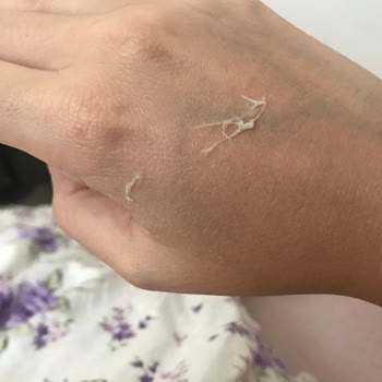 Sensodyne Diş Macunu Sonrası Ağızda Beyaz Oluşumlar Ve Rahatsızlık