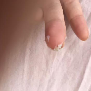 Sensodyne Diş Macunu Sonrası Ağızda Beyaz Oluşumlar Ve Rahatsızlık