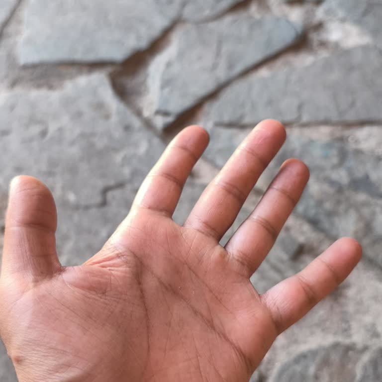 Kampanya Hediyelerim 2 Aydır Teslim Edilmedi Müşteri Hizmetleri Çözüm Sunmadı