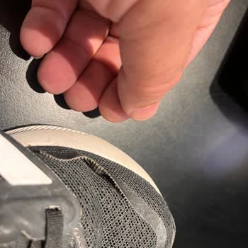 1 Haftada Deforme Olan Adidas Ayakkabı ve İade Talebi