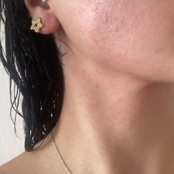 Watsons Micellar Yüz Temizleme Jeli Cildimde Alerjik Reaksiyona Sebep Oldu