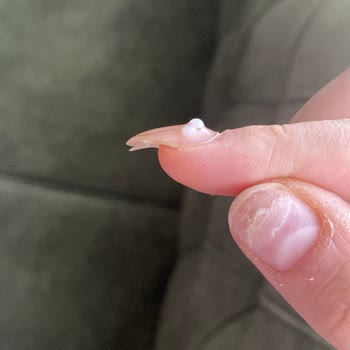 Protez Tırnaklar Bir Haftada Çıktı İşletme Geri Dönüş Yapmadı