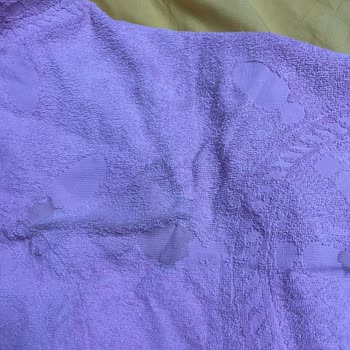 Yolculuk Sonrası Eşyalarımda Kan Lekesi Ve Mağduriyet