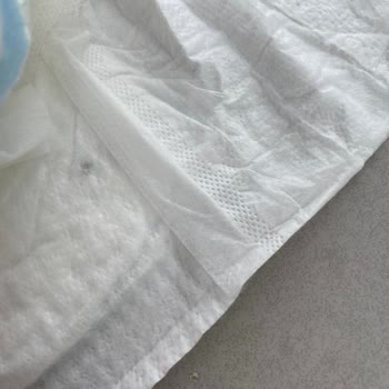 Bebek Bezinde Yabancı Cisim Çıktı, İade Ve Önlem Talep Ediyorum