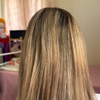 Saloon Oğuzhan Bosna Saçlarım İşlemden Zarar Gördü İstediğim Gibi Olmadı!