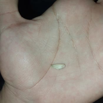 Hamburgerde Kemik Çıktı, Çalışanlar İlgilenmedi Ve Dalga Geçti