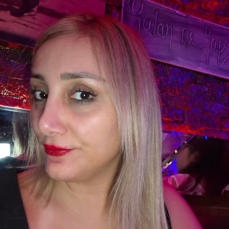 Saçım Yanlış Renge Boyandı Ve Ciddi Şekilde Yandı, İlgisiz Davrandılar