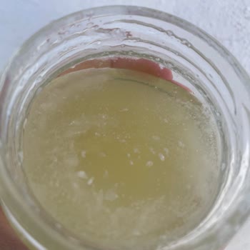 Watsons'dan Aldığım Hindistan Cevizi Yağı Sağlık Sorunu Yarattı