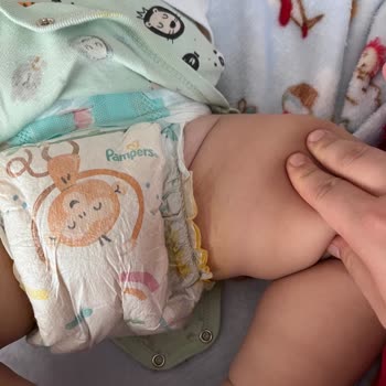 Prima 4 Numara Bebek Bezlerinde Sızdırma Ve Pişik Sorunu Mağduriyeti!