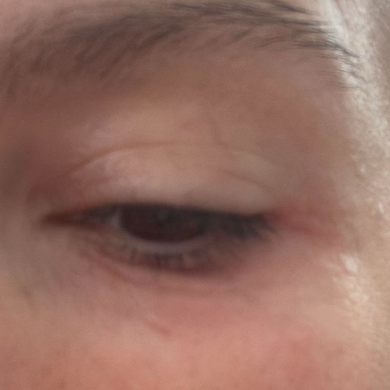 Yves Rocher Ürünü Cildimde Alerji Yaptı, İade Talebime Dönüş Yapılmadı