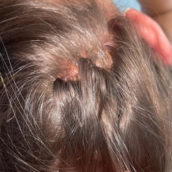 Saç Boyama Hizmetinde Ciddi Sağlık Sorunu Ve Yetersiz İlgi