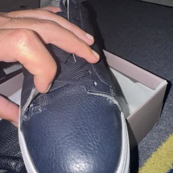 5 Ayda Açılan Ayakkabıya Garanti Reddi Ve Ücret İadesi Talebi