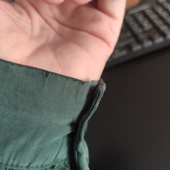 Kısa Sürede Deforme Olan Gömlek Mağduriyeti