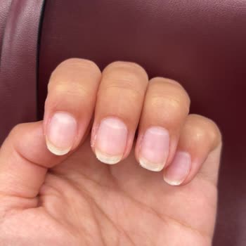 Eksik Ve İlgisiz Hizmet Nedeniyle Mağduriyet Yaşadım