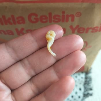 Siparişimde Çıkan Yabancı Cisim Çocuğumun Sağlığını Riske Attı