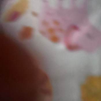 Aldığım Molfix Bezlerin Yan Bandajları Sürekli Yırtılıyor, Çözüm Bekliyorum