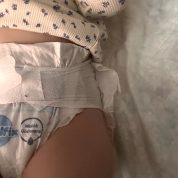 Aldığım Molfix Bezlerin Yan Bandajları Sürekli Yırtılıyor, Çözüm Bekliyorum