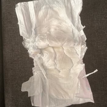 Aldığım Molfix Bezlerin Yan Bandajları Sürekli Yırtılıyor, Çözüm Bekliyorum