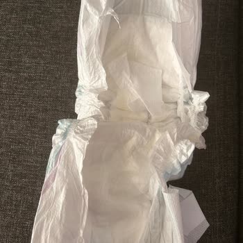 Aldığım Molfix Bezlerin Yan Bandajları Sürekli Yırtılıyor, Çözüm Bekliyorum