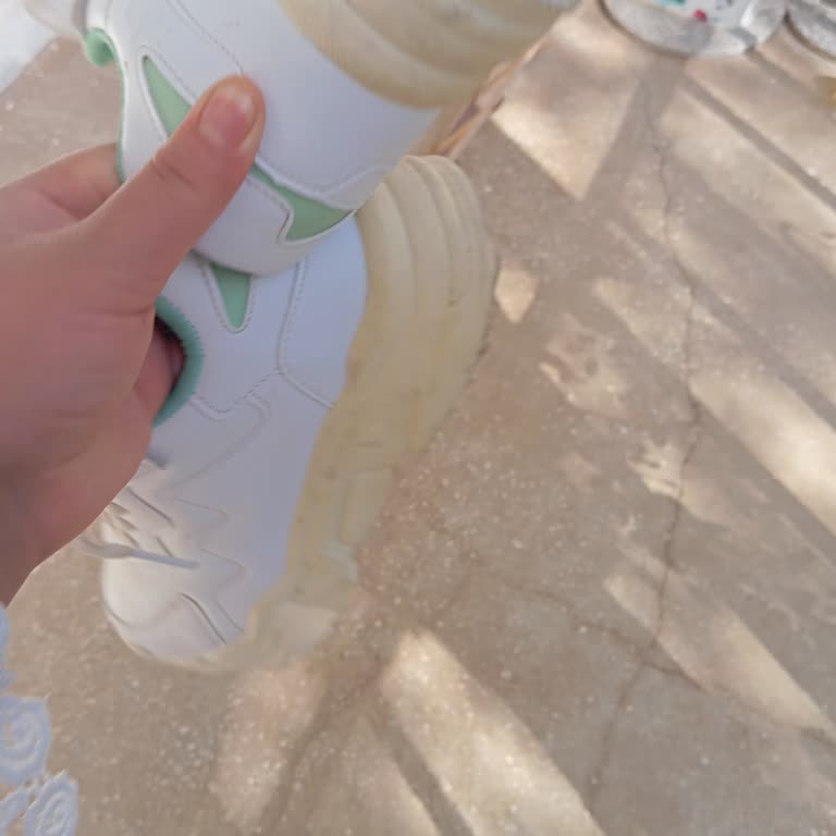 Kısa Sürede Sararan Ayakkabı İçin Garanti Talebim Reddedildi