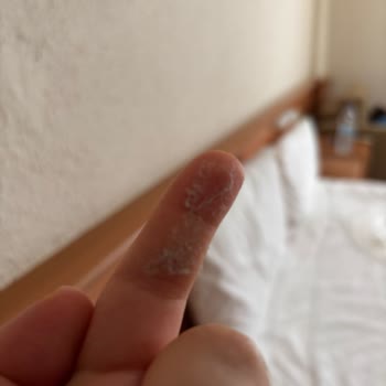 Oda Temizliği Ve Hizmet Yetersizliği Nedeniyle Mağduriyet Yaşadım