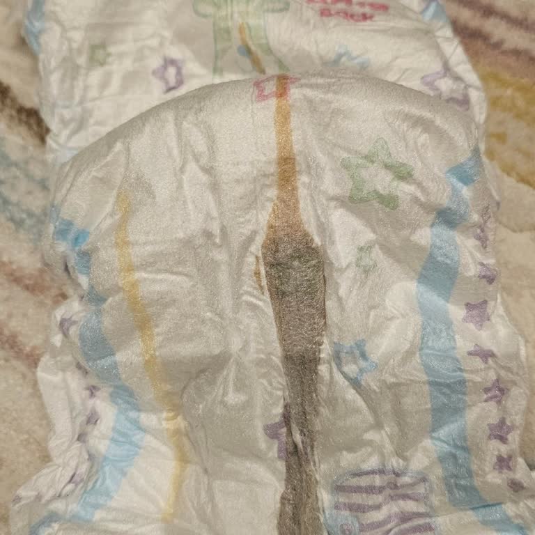 Bebek Bezi Paketinde Yabancı Cisimle Karşılaşılması Ve İade Talebi