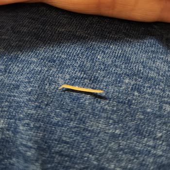 Ülker Çerez Paketinden Çıkan Tahta Parçası Damağıma Zarar Verdi, Güvenim Sarsıldı