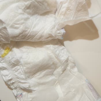 Molfix Bebek Bezinde Cam Macunu Benzeri Yabancı Maddeyle Karşılaştım