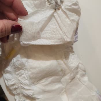 Molfix Bebek Bezinde Cam Macunu Benzeri Yabancı Maddeyle Karşılaştım