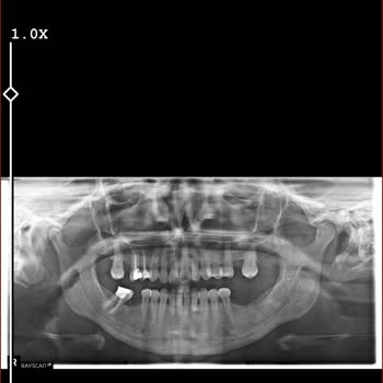 Diş Tedavisinde Yaşanan Aksaklıklar Ve Sağlık Sistemindeki Sorunlar