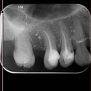 Diş Tedavisinde Yaşanan Aksaklıklar Ve Sağlık Sistemindeki Sorunlar