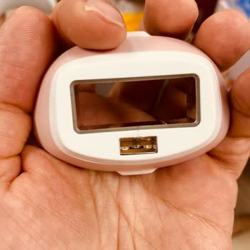 Philips Lumea Epilasyon Cihazımın Arızası Ve Servis Sürecindeki Mağduriyetim