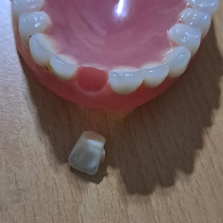 SmileNova Protez Dişlerim Kırılıyor